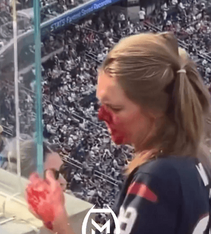 Steelers Nation Outraged After Female Fan Injured by Jets Attacked And Left With Blood on Her Face