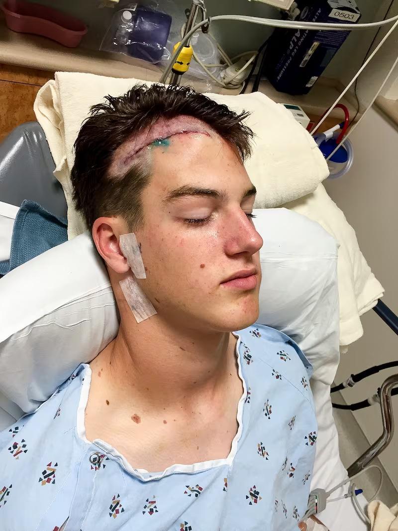 Eagles Quarterback Tanner McKee Beats Cancer to Become NFL Champion